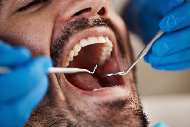 Best Root Canal Emergency Dentist  in Jay, OK